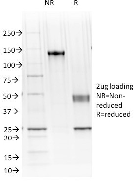 Ksp-Cadherin (Kidney-Specific Cadherin)/CDH16 Antibody in SDS-PAGE (SDS-PAGE)