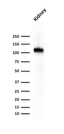 Ksp-Cadherin (Kidney-Specific Cadherin)/CDH16 Antibody in Western Blot (WB)