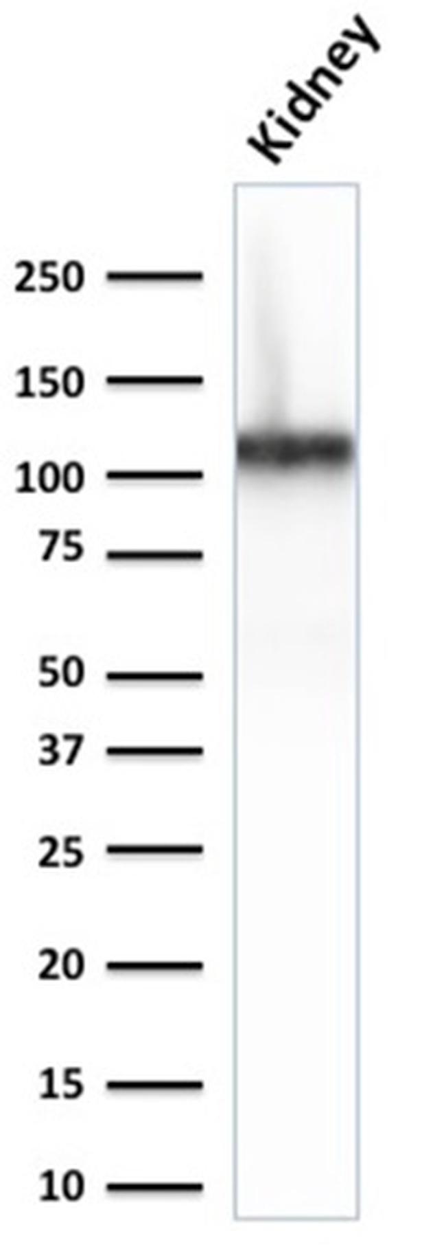 Ksp-Cadherin/CDH16 Antibody in Western Blot (WB)