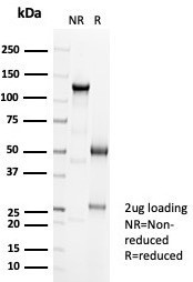 Ksp-Cadherin (Kidney-Specific Cadherin)/CDH16 Antibody in SDS-PAGE (SDS-PAGE)