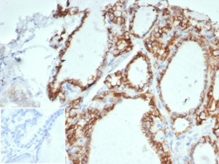 Ksp-Cadherin (Kidney-Specific Cadherin)/CDH16 Antibody in Immunohistochemistry (Paraffin) (IHC (P))