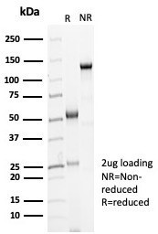 Ksp-Cadherin (Kidney-Specific Cadherin)/CDH16 Antibody in SDS-PAGE (SDS-PAGE)