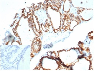 Ksp-Cadherin (Kidney-Specific Cadherin)/CDH16 Antibody in Immunohistochemistry (Paraffin) (IHC (P))