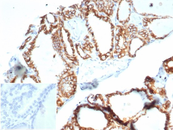 Ksp-Cadherin (Kidney-Specific Cadherin)/CDH16 Antibody in Immunohistochemistry (Paraffin) (IHC (P))