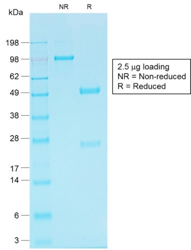 Ksp-Cadherin (Kidney-Specific Cadherin)/CDH16 Antibody in SDS-PAGE (SDS-PAGE)
