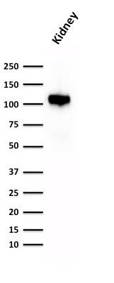 Ksp-Cadherin (Kidney-Specific Cadherin)/CDH16 Antibody in Western Blot (WB)