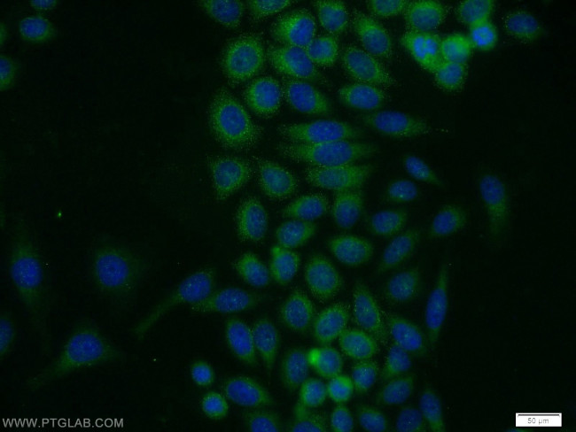 PRKAR2A Antibody in Immunocytochemistry (ICC/IF)