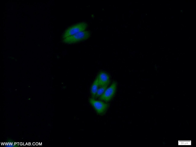 PRKAR2A Antibody in Immunocytochemistry (ICC/IF)