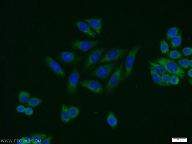 PRKAR2A Antibody in Immunocytochemistry (ICC/IF)