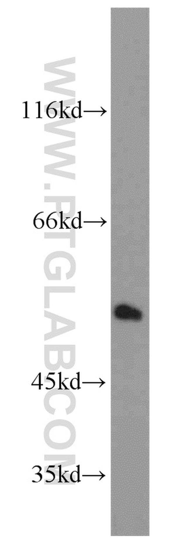 PRKAR2A Antibody in Western Blot (WB)