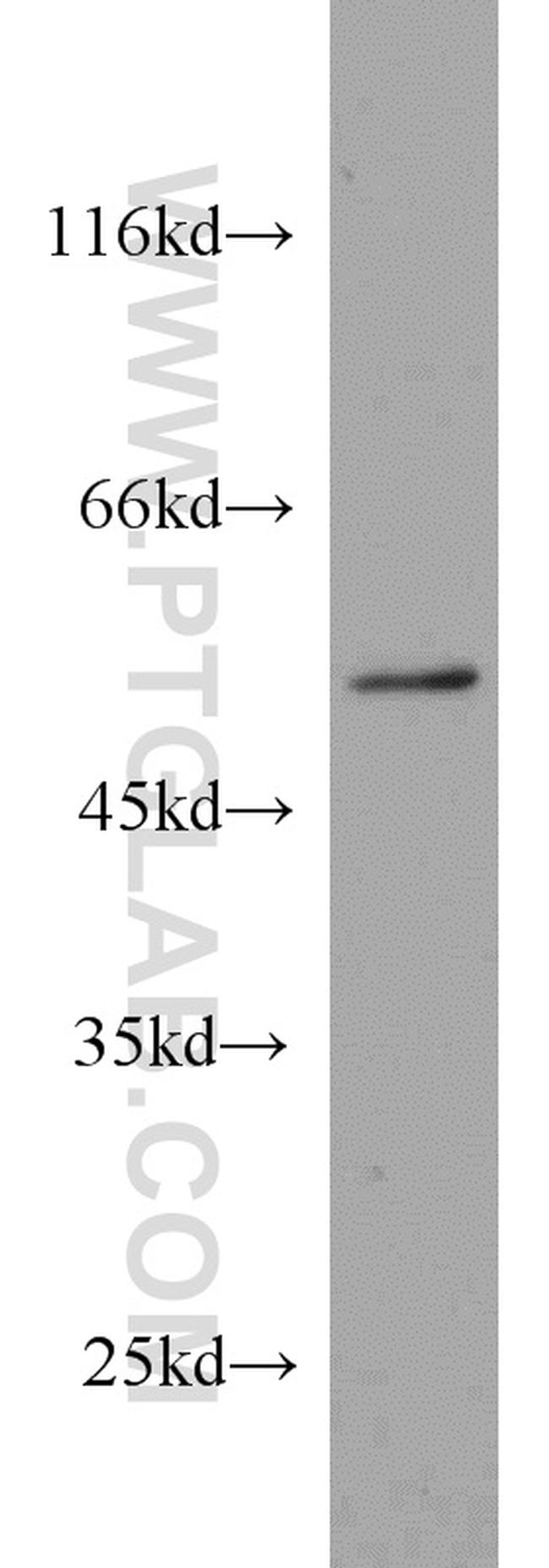 PRKAR2A Antibody in Western Blot (WB)