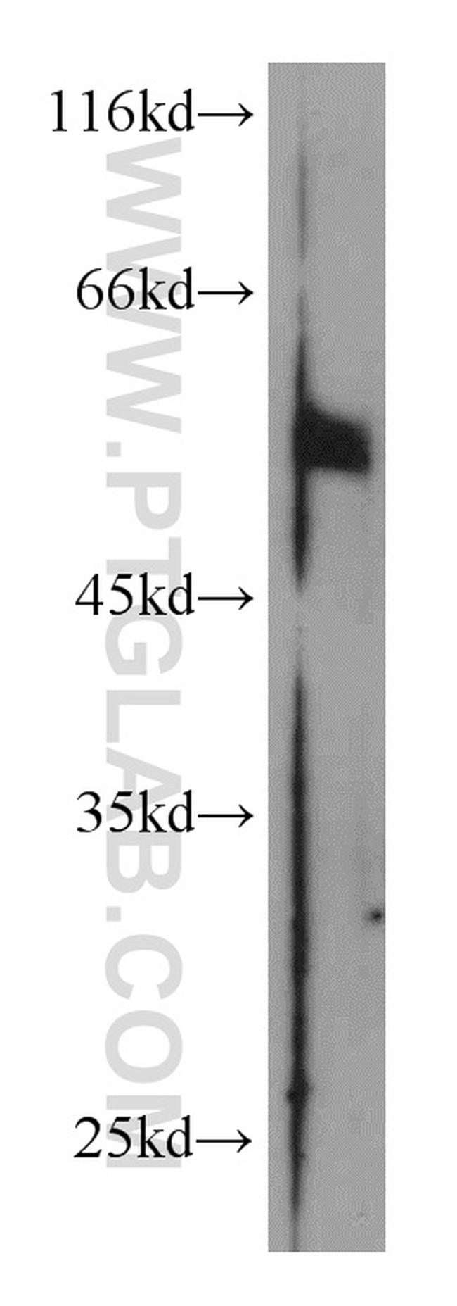 PRKAR2A Antibody in Western Blot (WB)