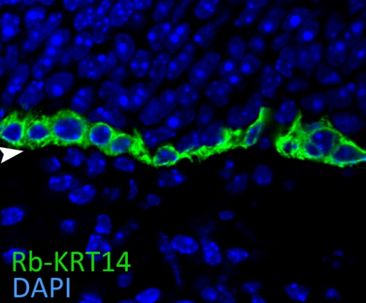 Cytokeratin 14 Antibody in Immunocytochemistry (ICC/IF)