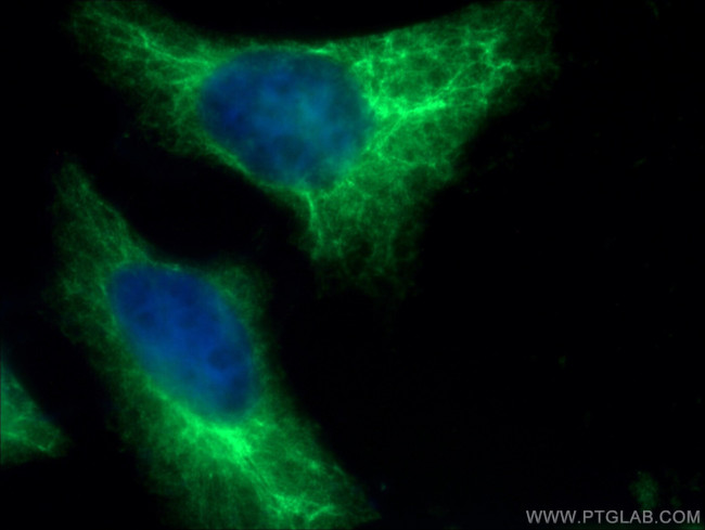 Cytokeratin 14 Antibody in Immunocytochemistry (ICC/IF)