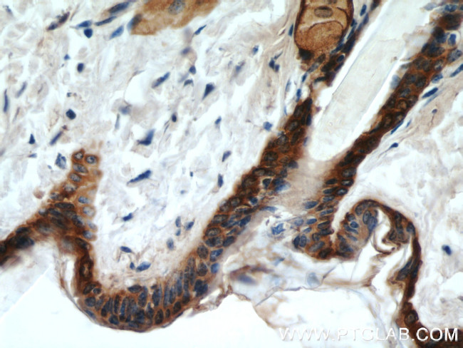 Cytokeratin 14 Antibody in Immunohistochemistry (Paraffin) (IHC (P))