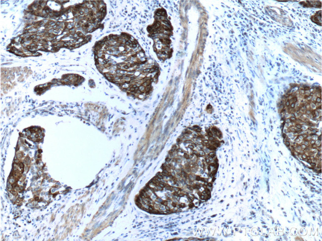 Cytokeratin 14 Antibody in Immunohistochemistry (Paraffin) (IHC (P))