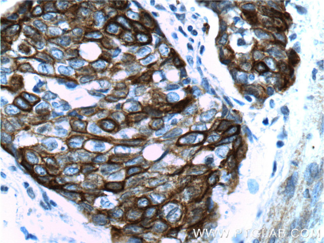 Cytokeratin 14 Antibody in Immunohistochemistry (Paraffin) (IHC (P))