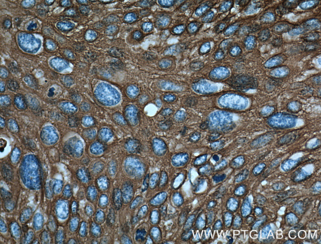 Cytokeratin 14 Antibody in Immunohistochemistry (Paraffin) (IHC (P))