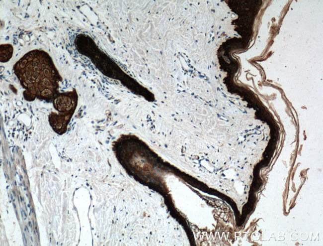 Cytokeratin 14 Antibody in Immunohistochemistry (Paraffin) (IHC (P))