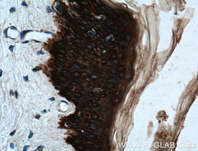 Cytokeratin 14 Antibody in Immunohistochemistry (Paraffin) (IHC (P))