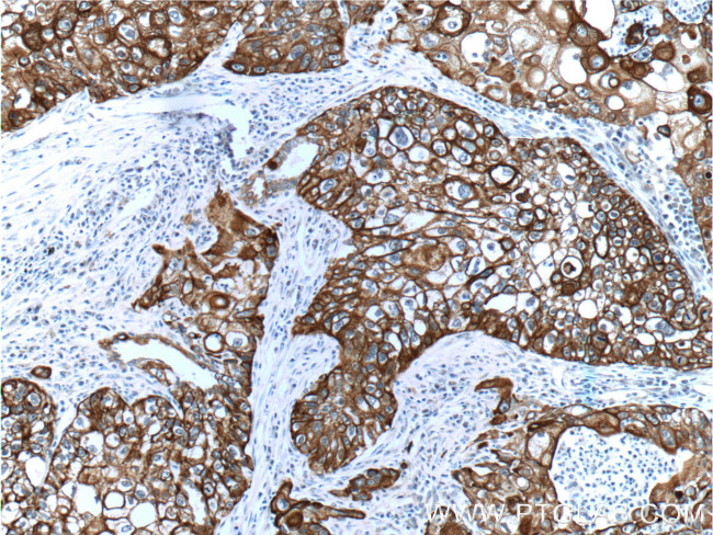 Cytokeratin 14 Antibody in Immunohistochemistry (Paraffin) (IHC (P))