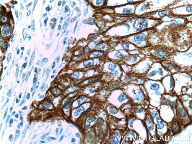 Cytokeratin 14 Antibody in Immunohistochemistry (Paraffin) (IHC (P))