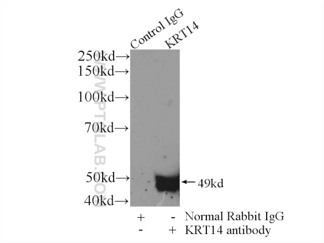 Cytokeratin 14 Antibody in Immunoprecipitation (IP)