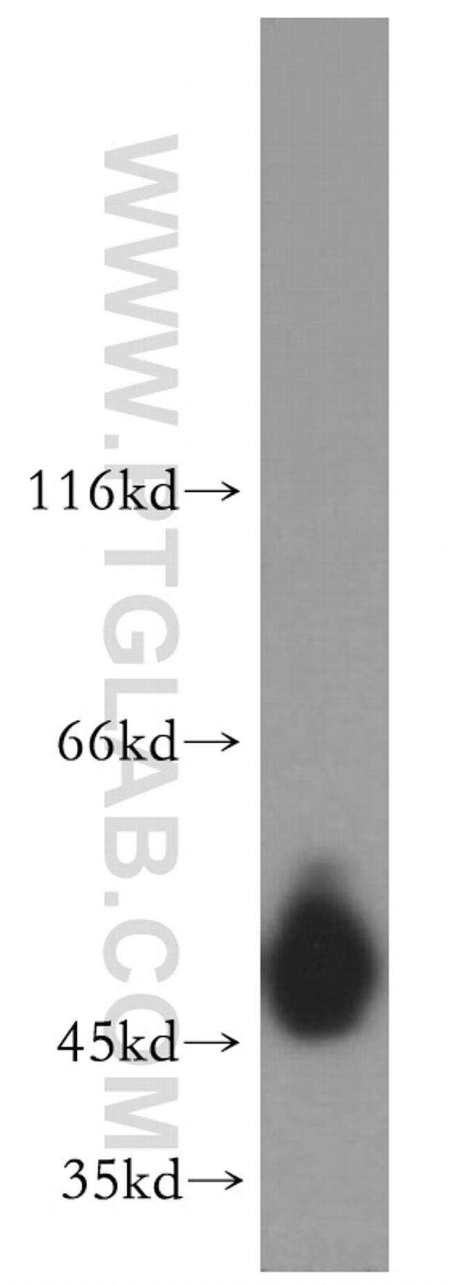 Cytokeratin 14 Antibody in Western Blot (WB)