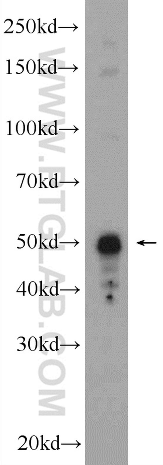 Cytokeratin 14 Antibody in Western Blot (WB)