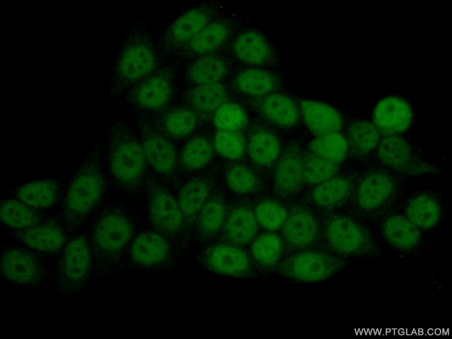 STAT1 Antibody in Immunocytochemistry (ICC/IF)