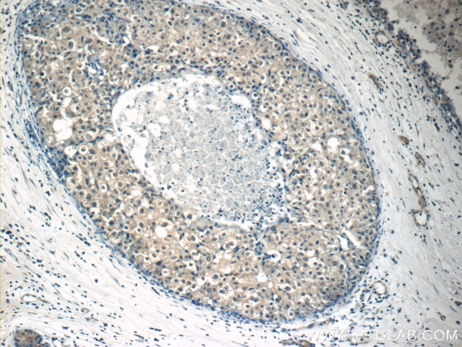 STAT1 Antibody in Immunohistochemistry (Paraffin) (IHC (P))