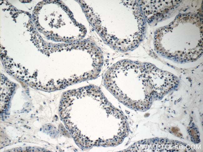 STAT1 Antibody in Immunohistochemistry (Paraffin) (IHC (P))