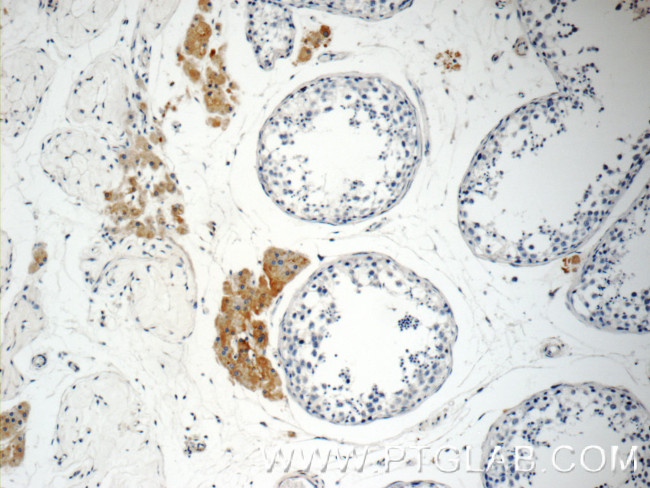 STAT1 Antibody in Immunohistochemistry (Paraffin) (IHC (P))