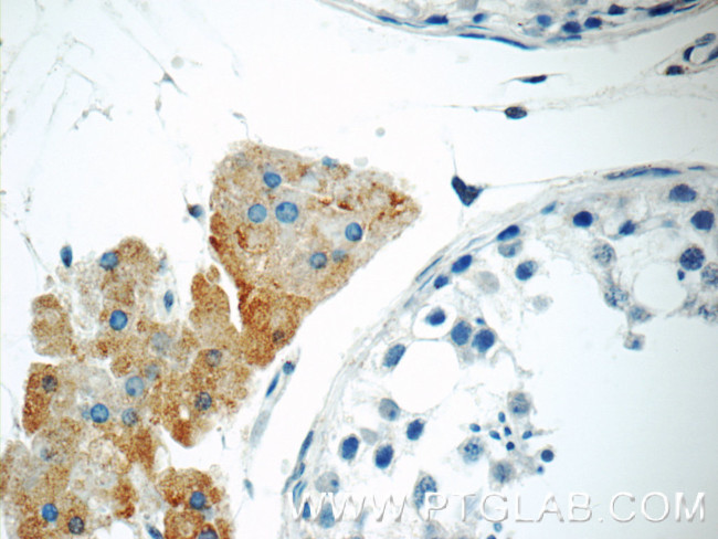 STAT1 Antibody in Immunohistochemistry (Paraffin) (IHC (P))