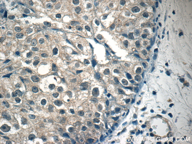 STAT1 Antibody in Immunohistochemistry (Paraffin) (IHC (P))