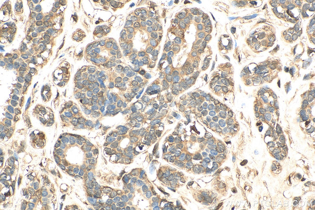 STAT1 Antibody in Immunohistochemistry (Paraffin) (IHC (P))