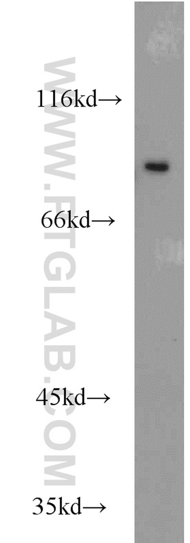 STAT1 Antibody in Western Blot (WB)