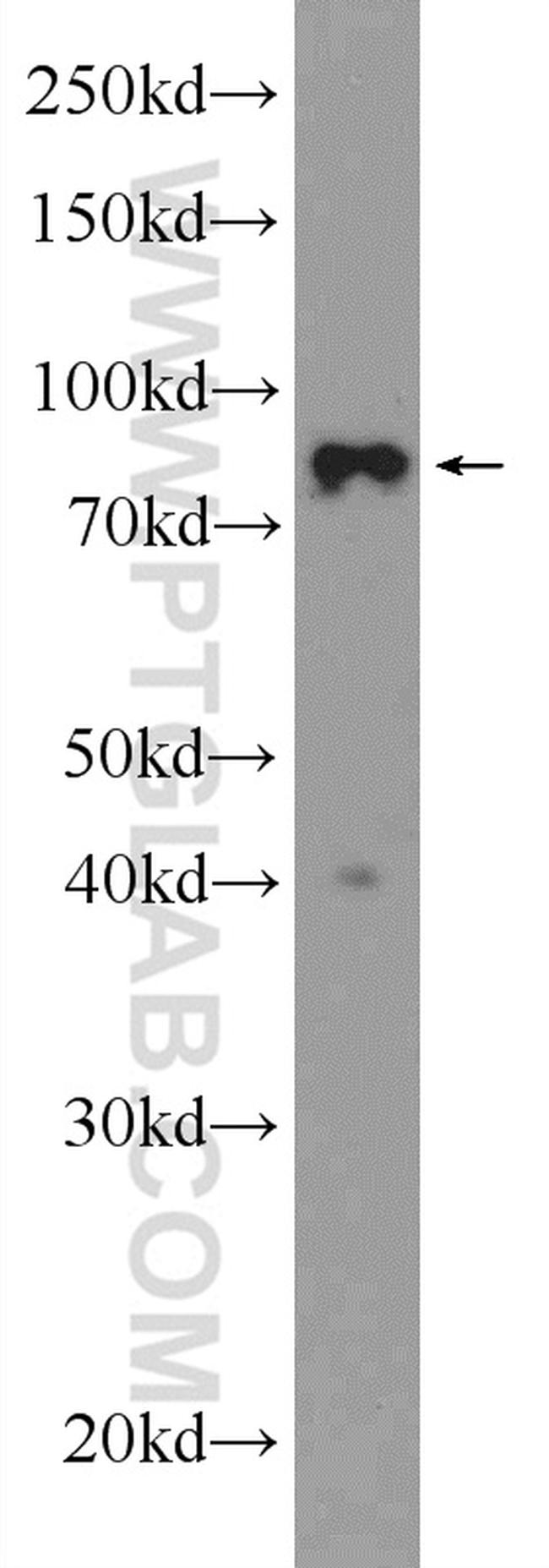 STAT1 Antibody in Western Blot (WB)