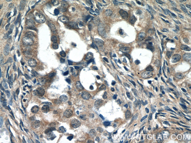 PREB Antibody in Immunohistochemistry (Paraffin) (IHC (P))