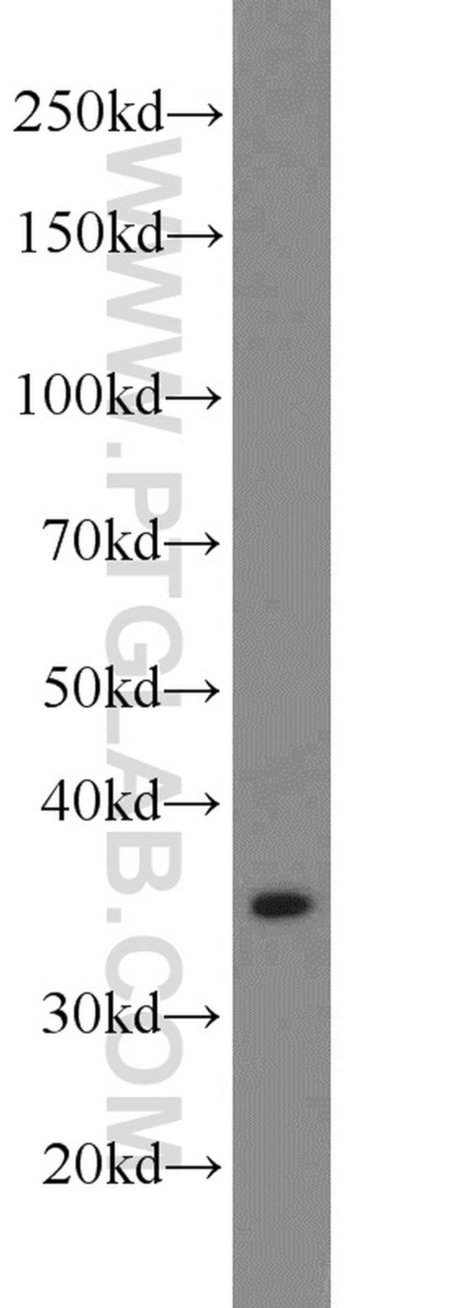 PREB Antibody in Western Blot (WB)