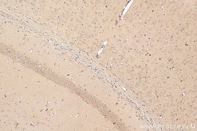 tPA Antibody in Immunohistochemistry (Paraffin) (IHC (P))