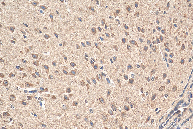 tPA Antibody in Immunohistochemistry (Paraffin) (IHC (P))