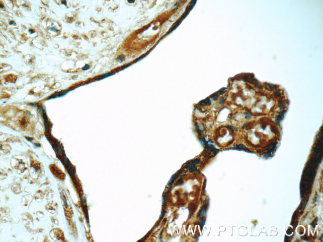 tPA Antibody in Immunohistochemistry (Paraffin) (IHC (P))