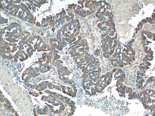 tPA Antibody in Immunohistochemistry (Paraffin) (IHC (P))