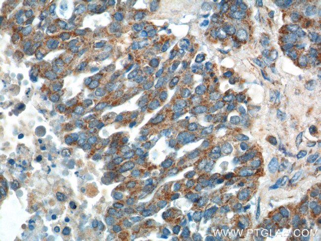 tPA Antibody in Immunohistochemistry (Paraffin) (IHC (P))