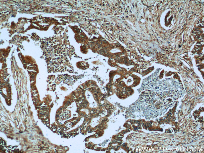 tPA Antibody in Immunohistochemistry (Paraffin) (IHC (P))