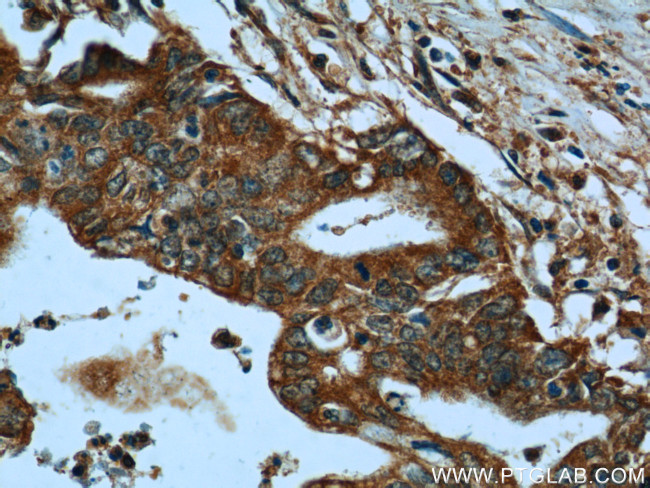 tPA Antibody in Immunohistochemistry (Paraffin) (IHC (P))