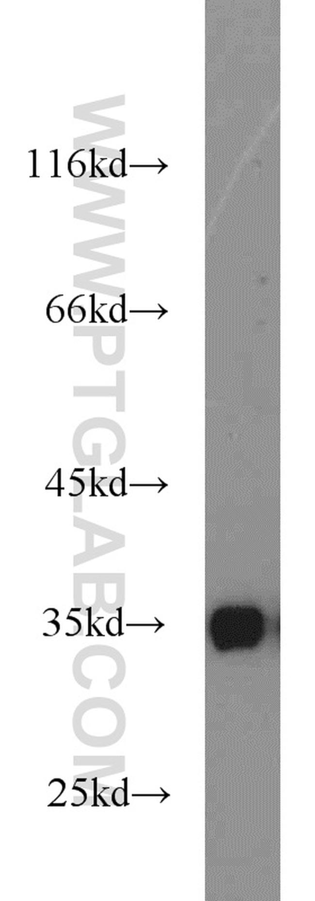 tPA Antibody in Western Blot (WB)