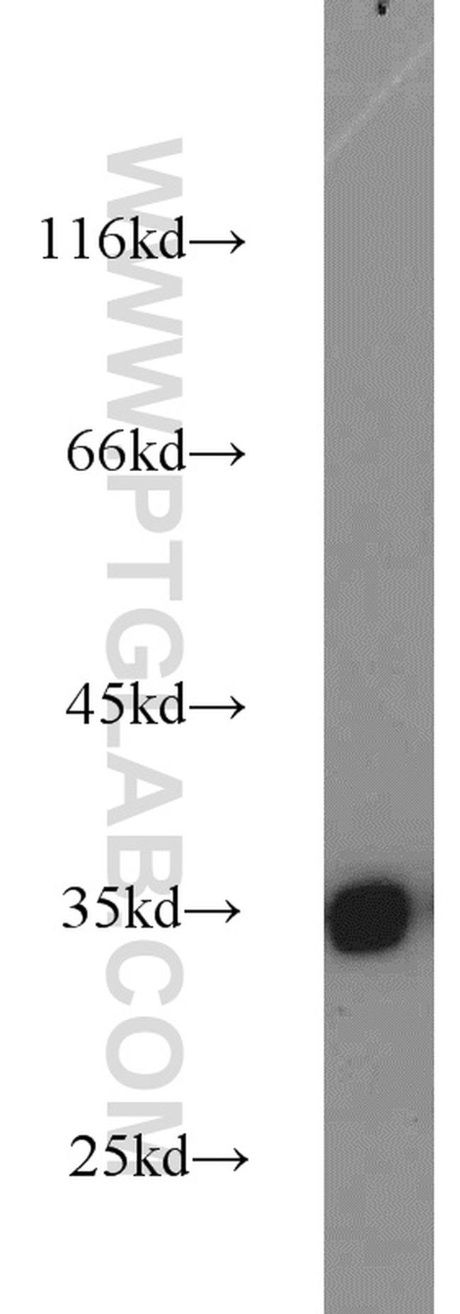 tPA Antibody in Western Blot (WB)