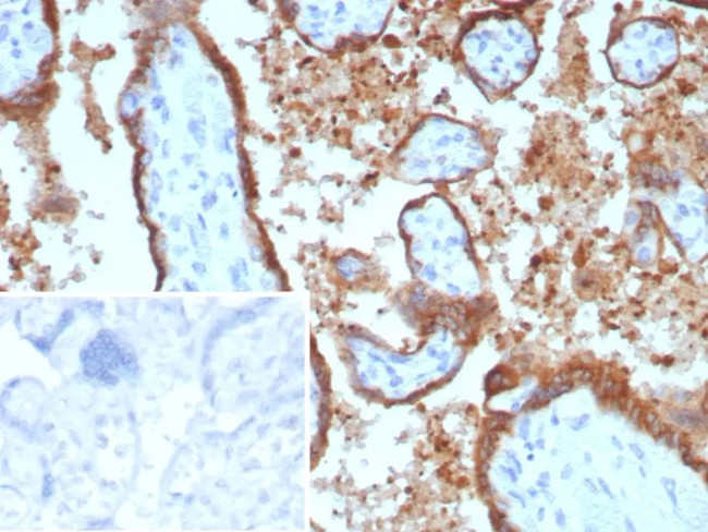 EBI3/Epstein-Barr virus induced 3 Antibody in Immunohistochemistry (Paraffin) (IHC (P))